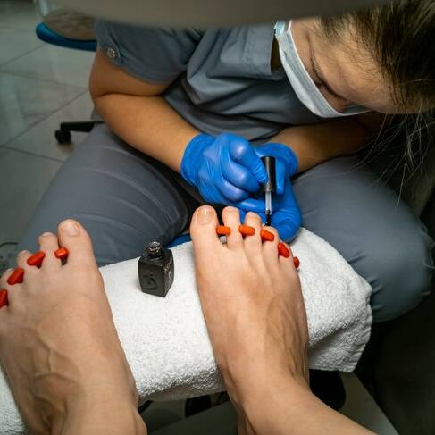 tratamiento especializado para uñas de pies